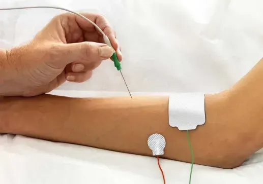 Abstract neural pathway visualization representing electrodiagnostic nerve assessment