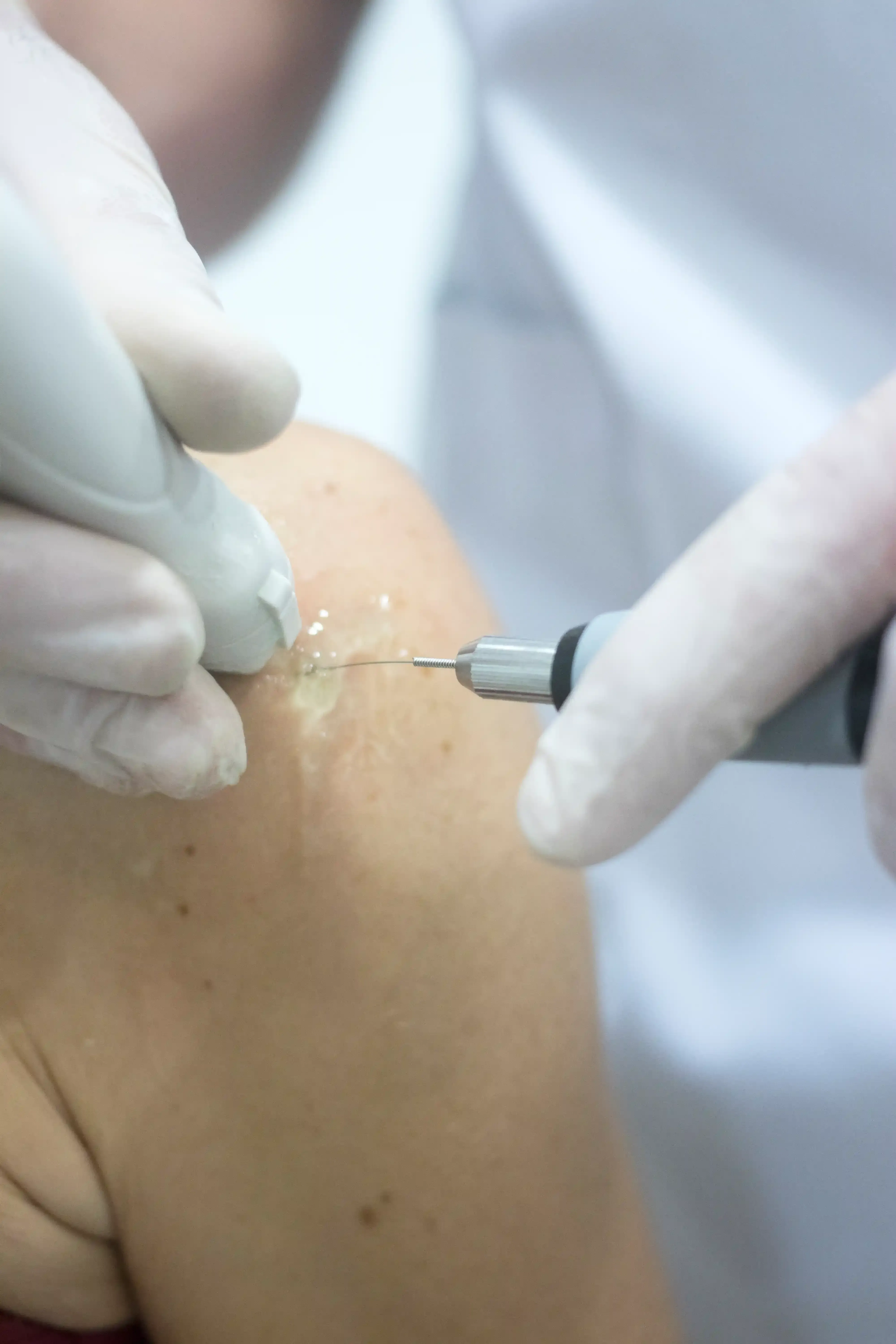 Dr. Reznikov discussing nerve block benefits with a patient