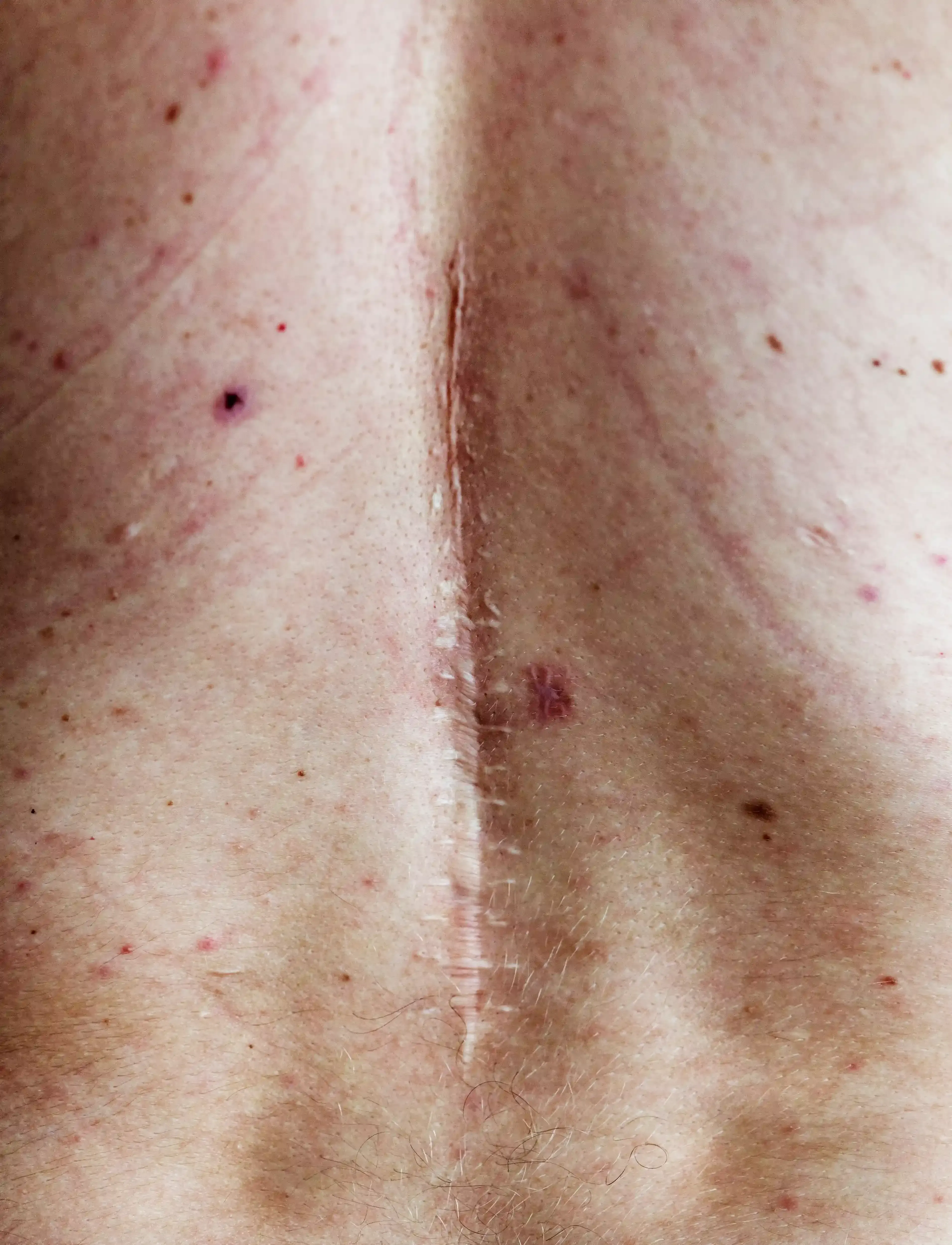Why Patients Choose PTCOFMD for Post-Surgical Pain Care